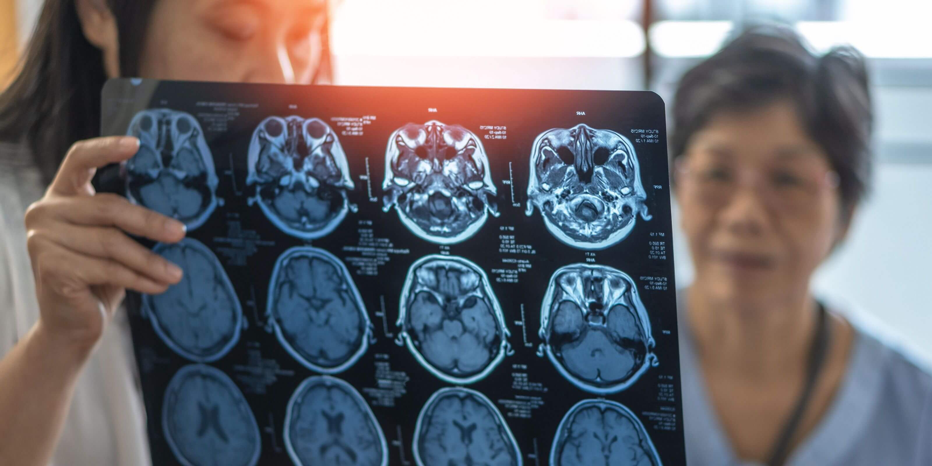 Doctor and patient looking at brain scans 